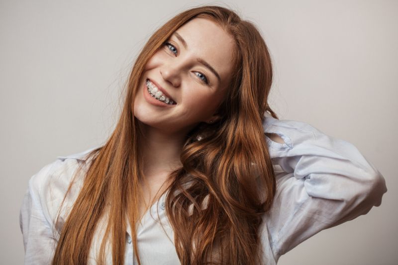 Clear Braces treatment at Union Orthodontics + Pediatric Dentistry