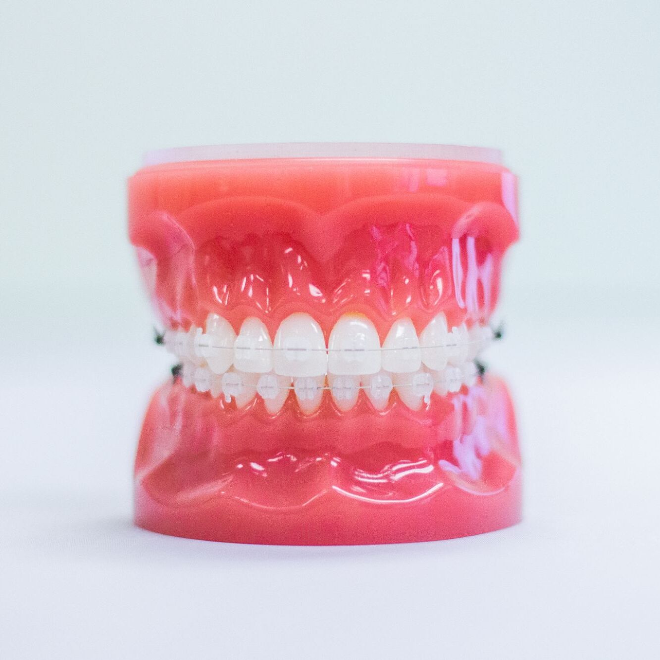 Clear (Ceramic) Braces