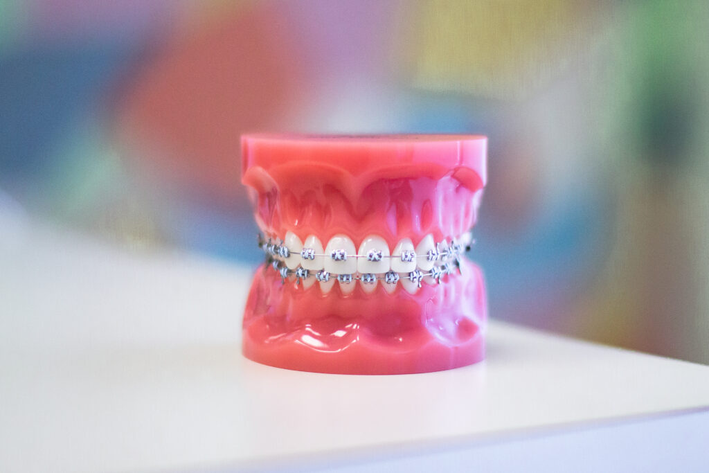 How to Choose the Right Orthodontist