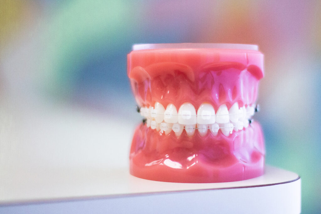 How to Choose the Right Orthodontist