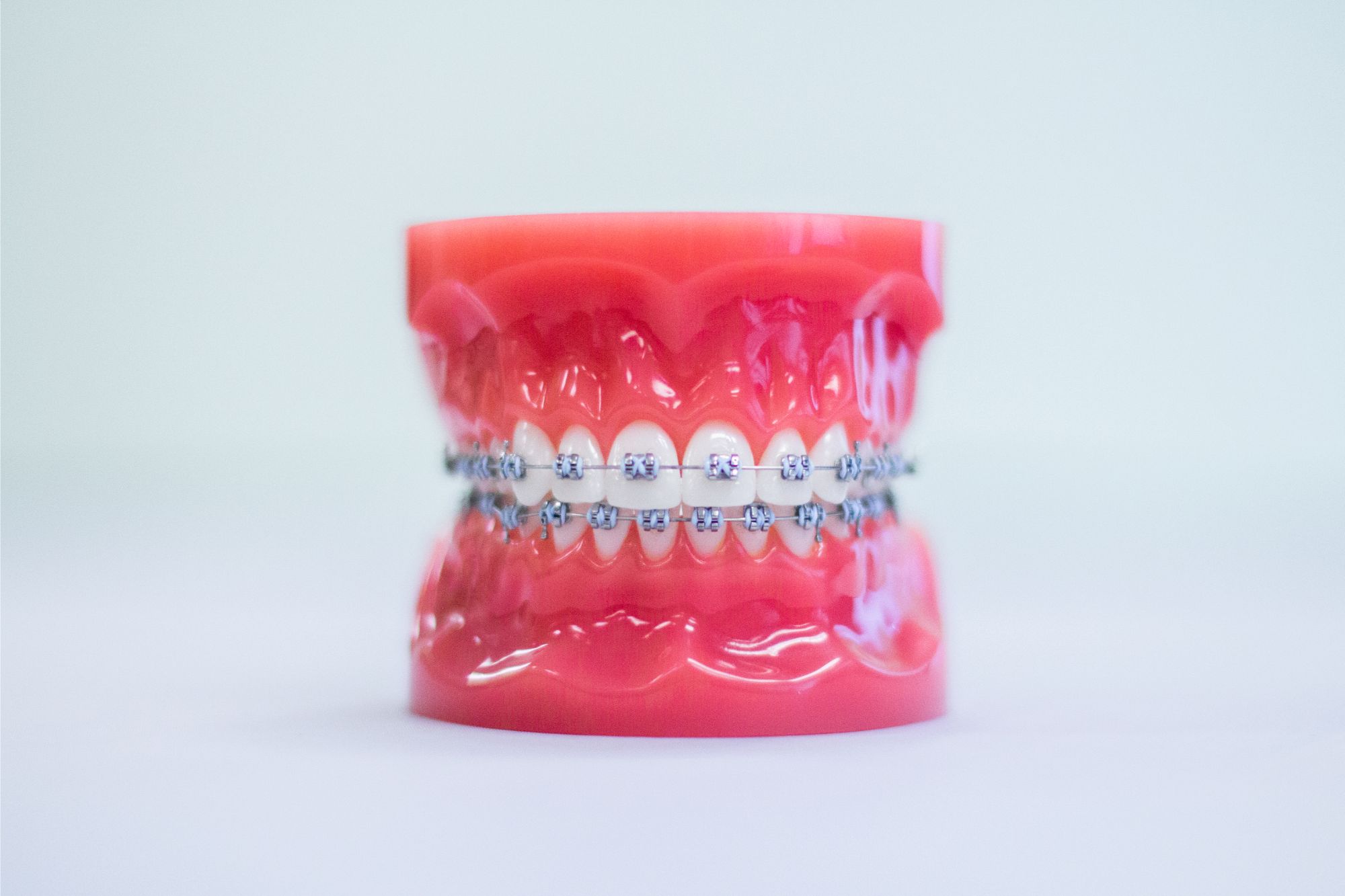 Braces Denver
